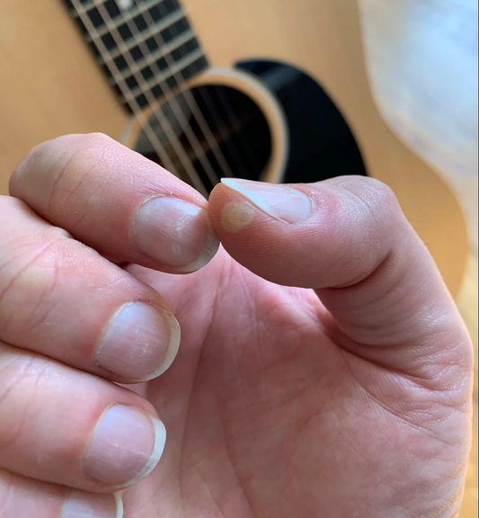 Guitar Gloves for Arthritis Relief | Play Pain-Free with AcoustiX